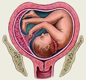 Особенности беременности при седловидной матке