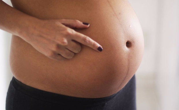 Темная полоса на животе беременной