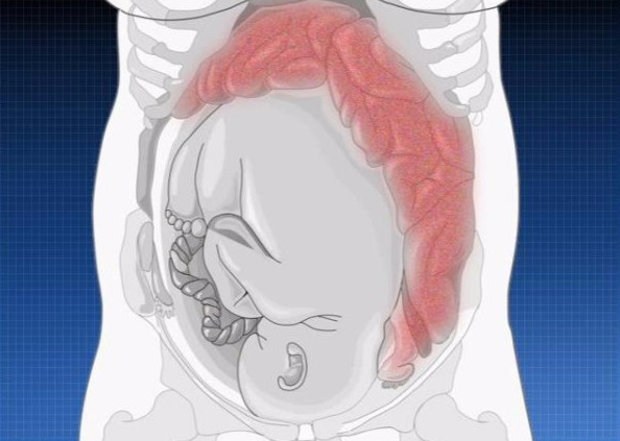 Положение кишечника беременной