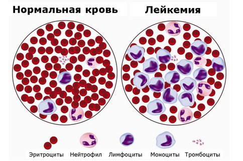 Картинки лейкоз крс