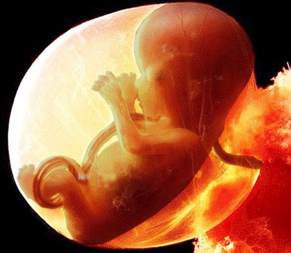 10 ноября неделя. Эмбрион на 11 неделе беременности. 11 Недель беременности фото плода. Фото плода 11 недель беременности фото. Зародыш на 11 неделе беременности.