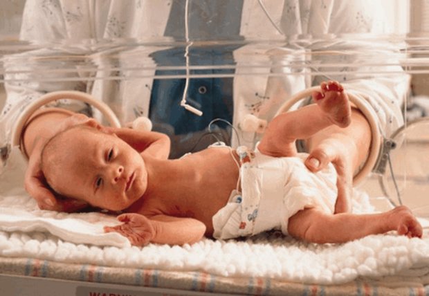 Гидроцефалия и новорожденного