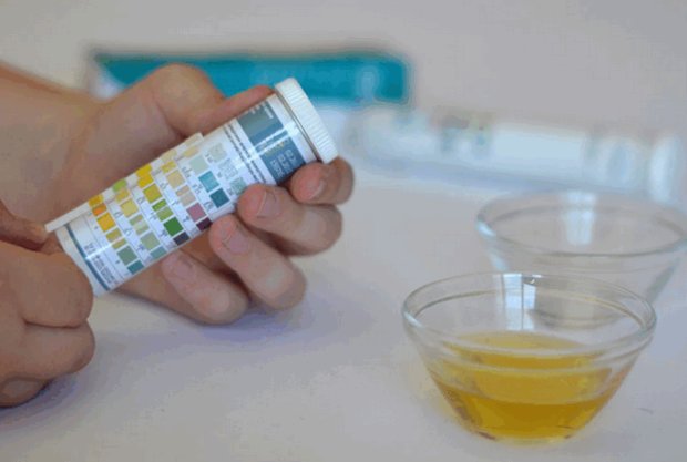 Тест на белок в моче в домашних условиях