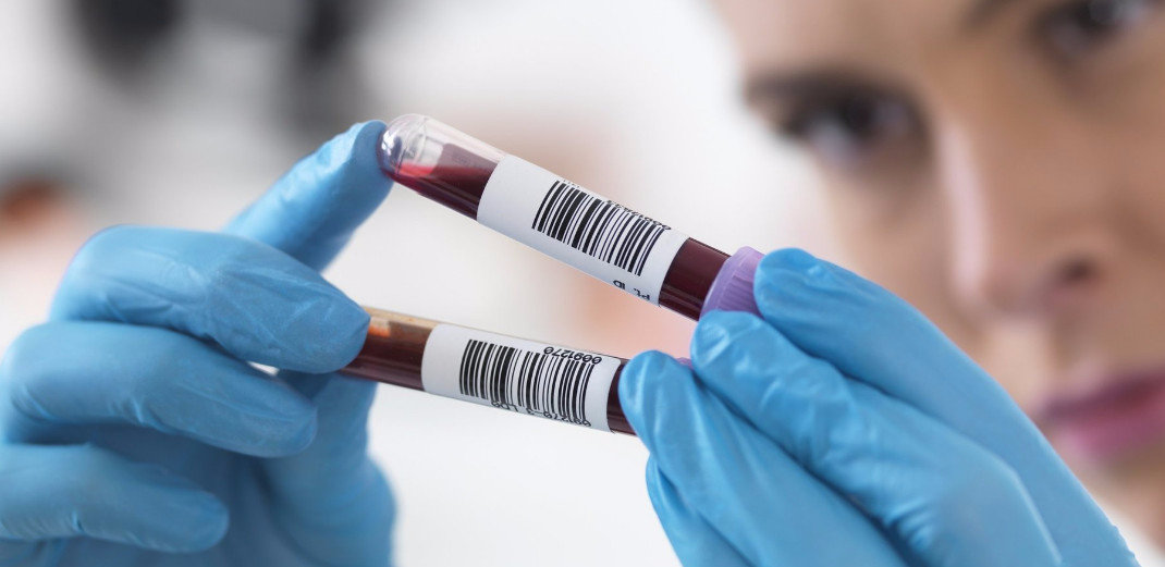 Лютеинизирующий гормон (ЛГ, LH, лютеотропин, лютропин): норма у женщин