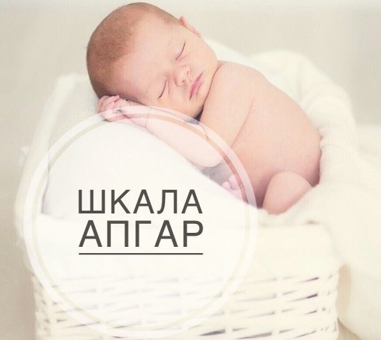 Шкала Апгар: что такое и как проходит первая оценка новорожденного