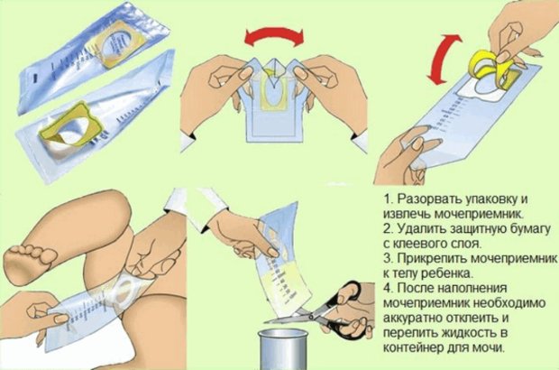 Инструкция использования мочеприемника