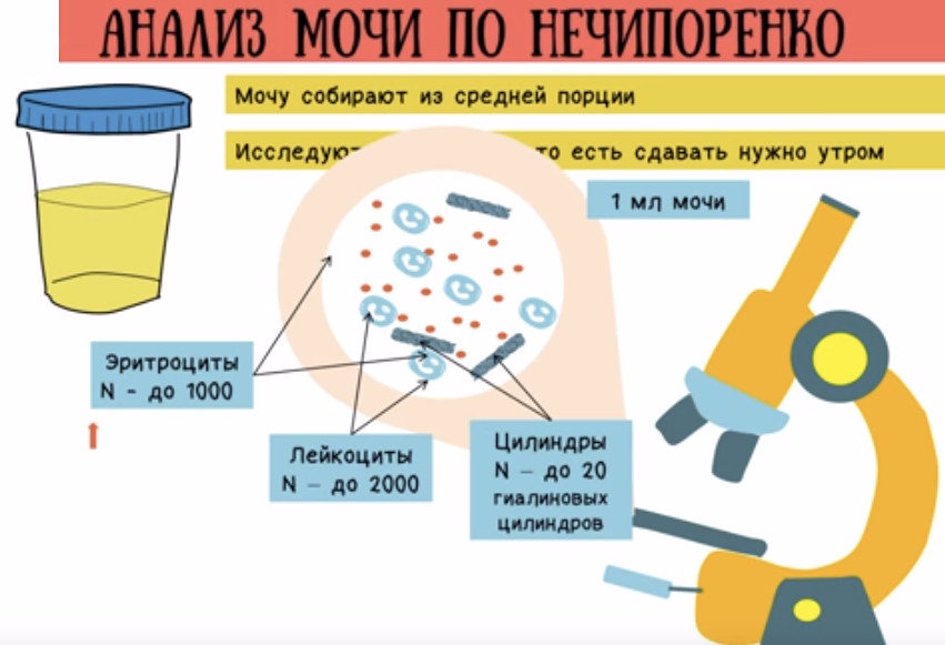 анализ мочи по нечипоренко