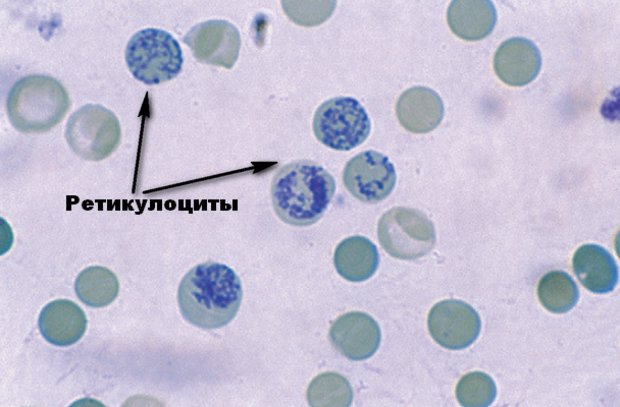 Ретикулоциты