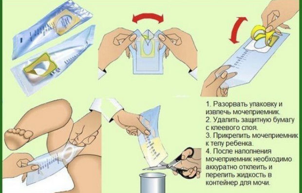 Как собрать мочу: инструкция по применению мочеприемника для новорождённых