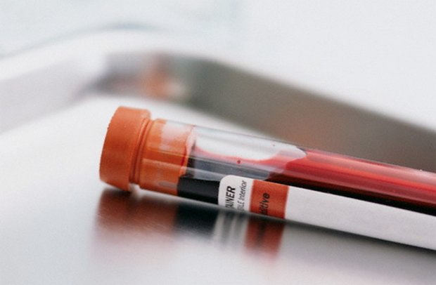 анализ крови на ХГЧ