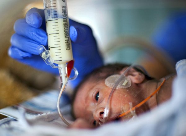 Зонд для кормления новорождённых: алгоритм и техника кормления ребёнка через зонд, фото